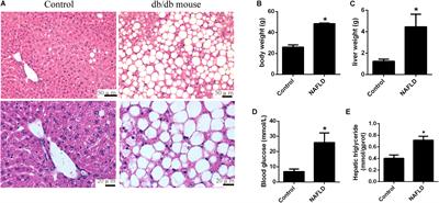 LncRNA-AK012226 Is Involved in Fat Accumulation in db/db Mice Fatty Liver and Non-alcoholic Fatty Liver Disease Cell Model